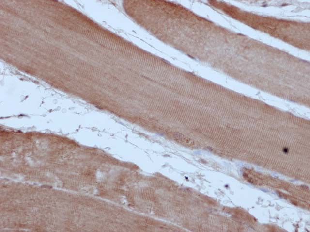 60-0114 61-0114 Ms x Myoglobin stained skeletal muscle 