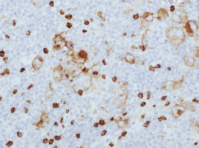 60-0119 61-0119 Ms x CD15 stained HD 