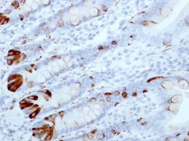 60-0122 61-0122 RbMab x SYN stained small intestine 