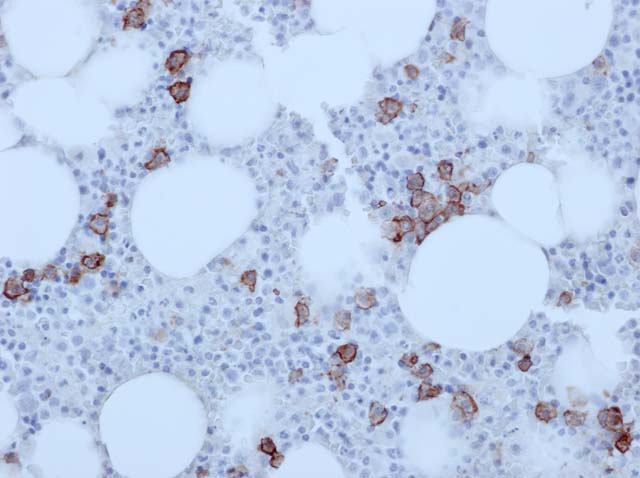 60-0108 61-0108 Ms x CD138 Stained Myeloma 