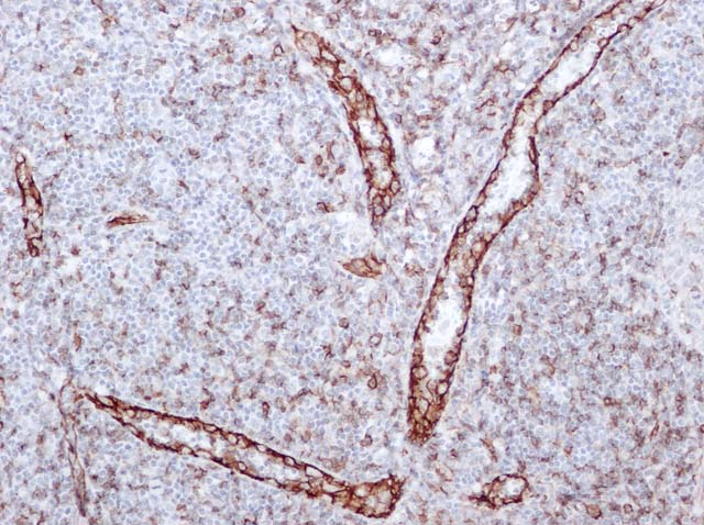 60-0072 61-0072 Ms x CD31 stained Tonsil 
