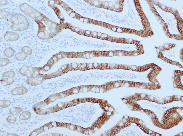 60-0023 61-0023 Ms x pan CK AE1_AE3 small intestine 