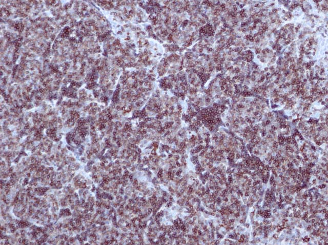 60-0143 61-0143 Ms x CD1a stained Thymus 