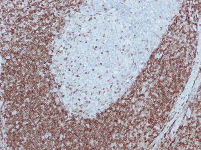 60-0005 61-0005 Ms x Bcl2 stained tonsil