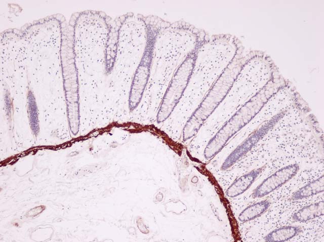 60-0105 61-0105 Ms x Calponin N Array Colon x10