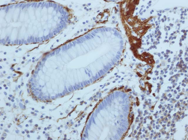 60-0002 61-0002 Ms x muscle actin colon 