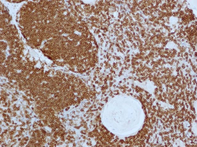 60-0011 61-0011 Ms x CD3 Thymus