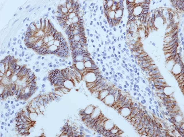 60-0132 61-0132 Ms x Ep-Cam stained small intestine 
