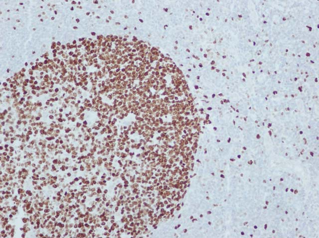 60-0040 61-0040 Ms x Ki67 Clone GM001 Tonsil 