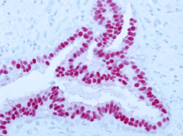 52-0020 Rb x PR stained breast tissue x40 PowerStain 1 step AP