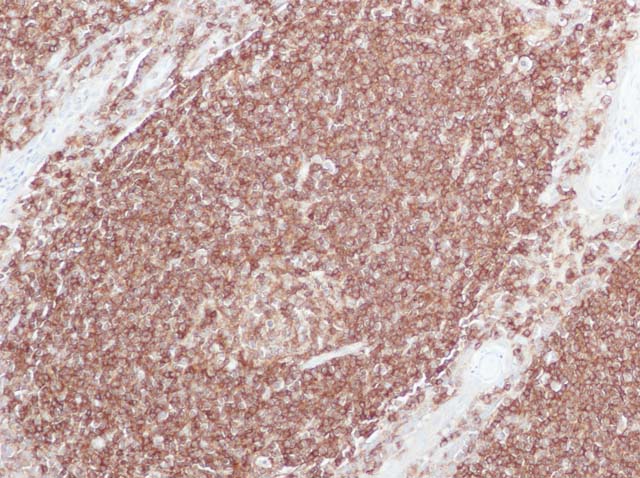 60-0041 61-0041 Ms x LCA cocktail Tonsil 