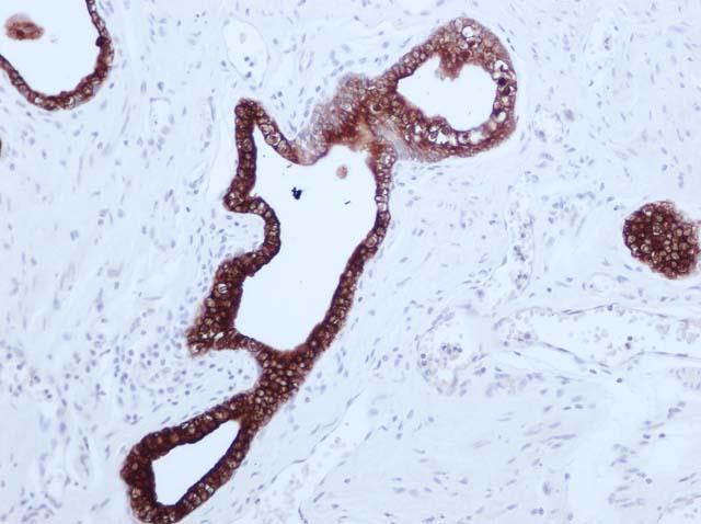 60-0104 61-0104 Ms x PsAP stained prostate 