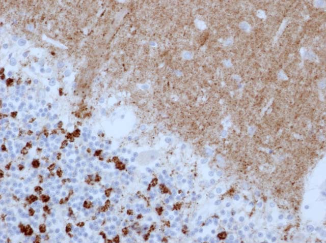 60-0122 61-0122 RbMab x SYN stained cerebellum 
