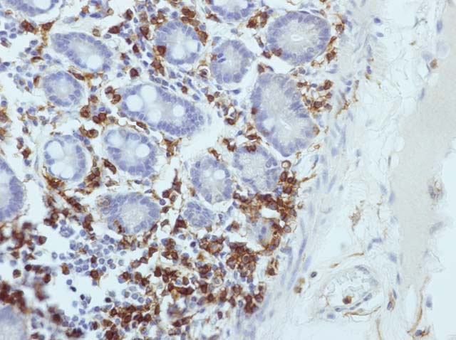60-0013 61-0013 Ms x CD45RO Small Intestine 