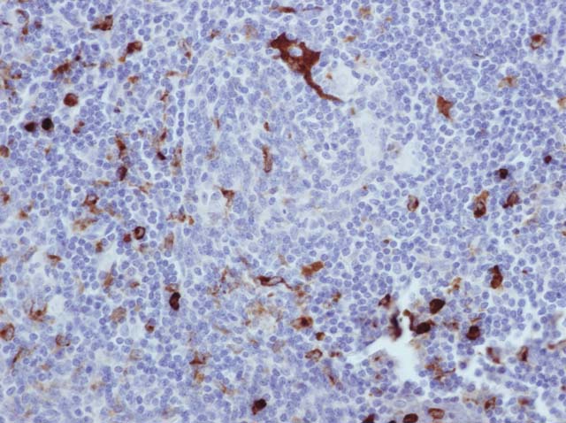 60-0118 61-0118 Rb x Lysozyme stained thymus 