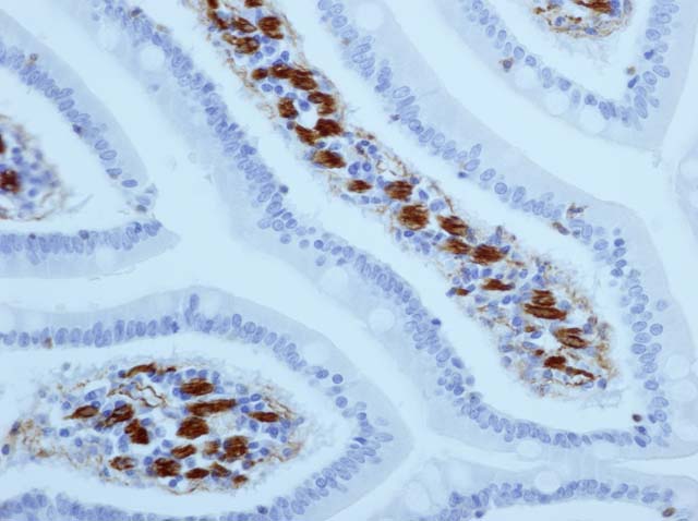 60-0002 61-0002 Ms x muscle actin small intestine 