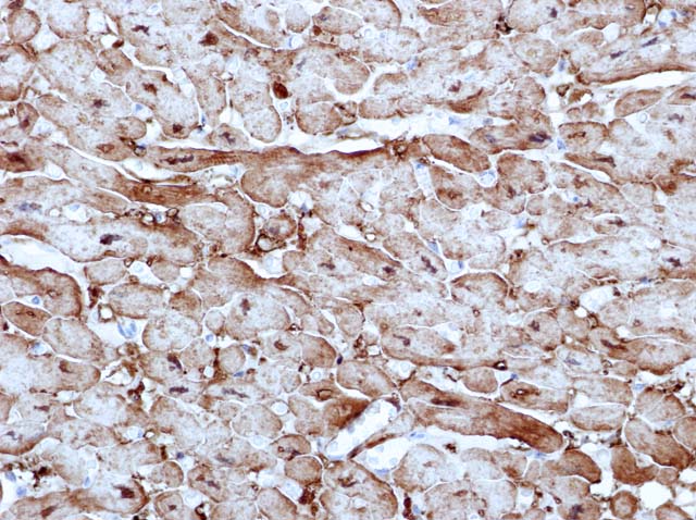60-0114 61-0114 Ms x Myoglobin stained heart muscle 