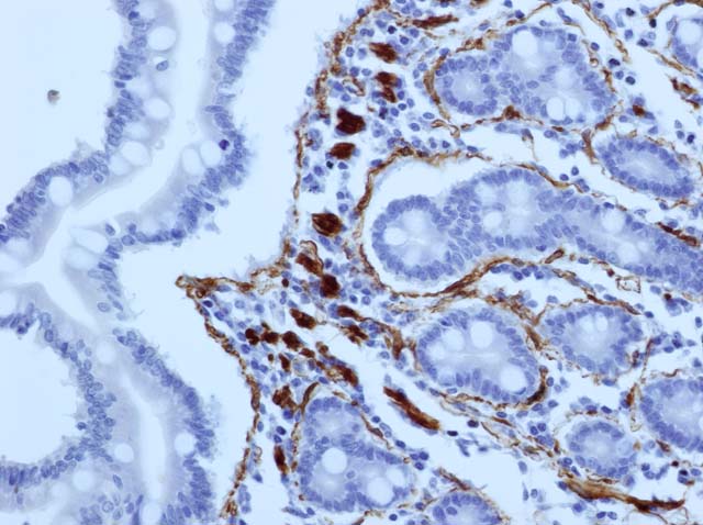 60-0001 61-0001 Ms x Actin 1A4 small instestine 