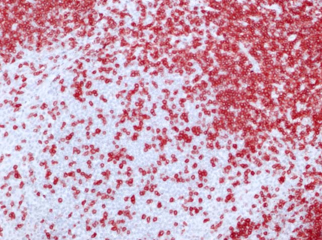 52-0022 54-0022 Rb x CD3 stained Tonsil X20.jpg