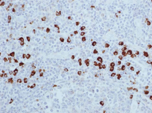 60-0038 61-0038 Ms x lambda tonsil