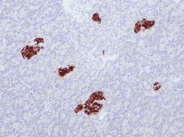 60-0039 61-0039 Ms x Insulin stained pancreas 