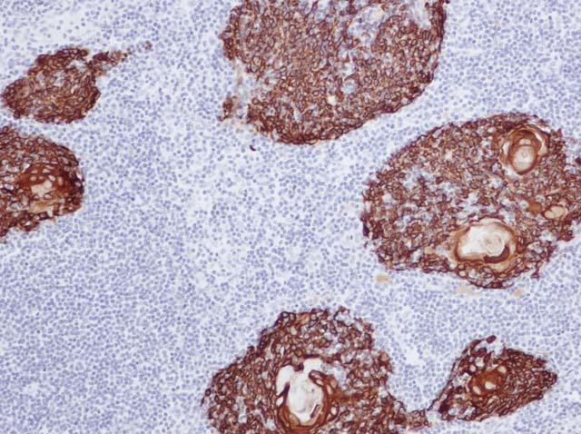 60-0025 61-0025 Ms x CK HMW Thymus 