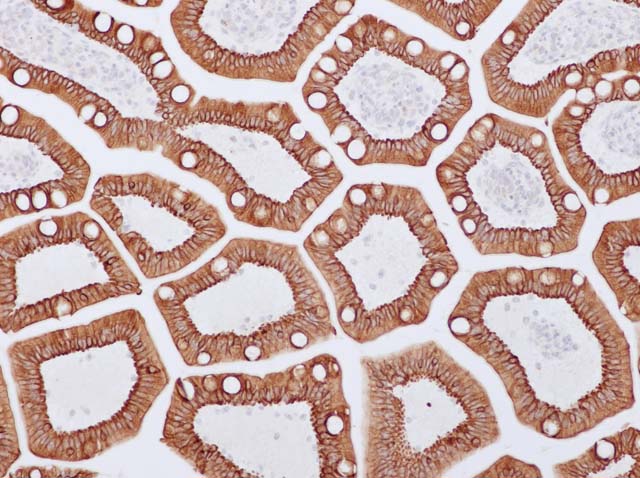 60-0017 61-0017 Ms x CK18 small intestine 