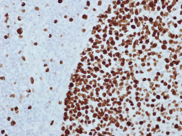 60-0078 61-0078 Ms x Ki67 Clone GM010 Stained Tonsil 