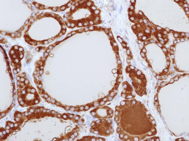 60-0064 61-0064 Ms x Thyroglobulin Thyroid Hyperplasia 