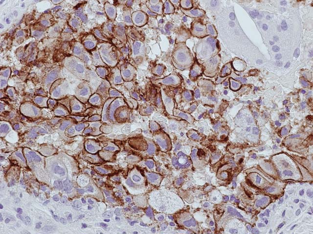 60-0033 61-0033 Ms x HER2 TAB250 Ficin Breast Cancer 