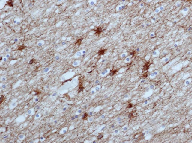 60-0032 61-0032 Rb x GFAP Cerebral Cortex