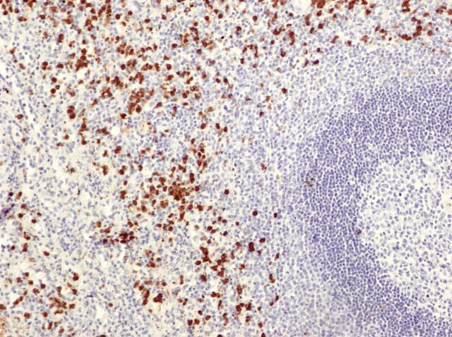 60-0119 61-0119 Ms x CD15 spleen 