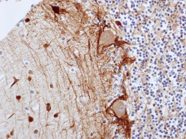 60-0048 61-0048 Ms x NFs 2F11 cerebellum 