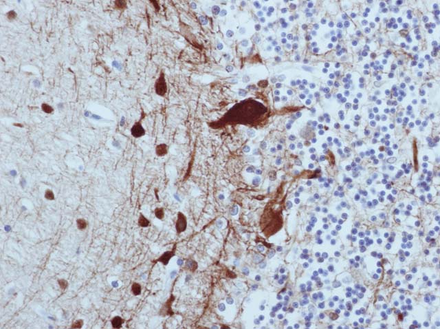 60-0048 61-0048 Ms x NFs cerebellum