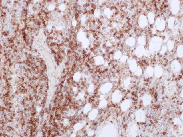 60-0126 61-0126 Ms x CD4 DLBL 
