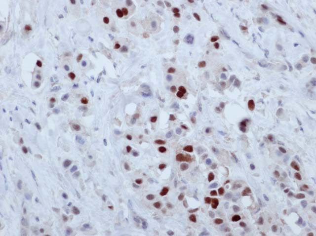 60-0021 61-0021 Ms x CyclinD1 RTU Breast Ca 101310 