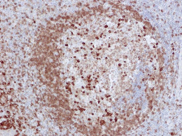 60-0095 61-0095 Ms x CD79a Tonsil 