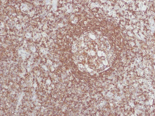 60-0041 61-0041 Ms x LCA Tonsil