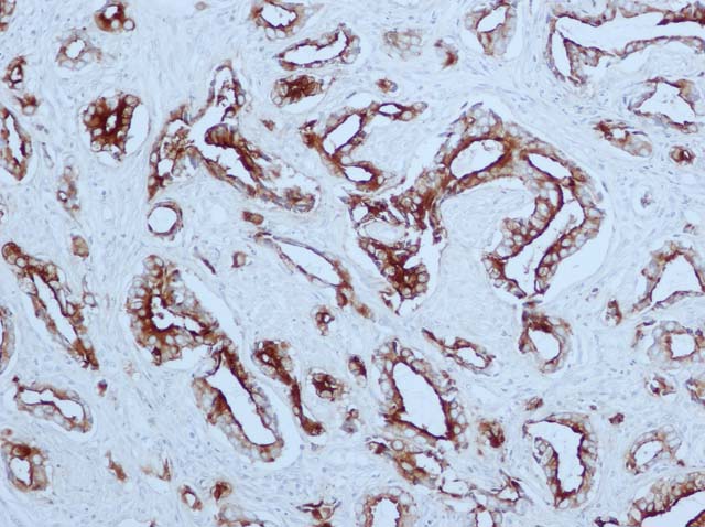 60-0057 61-0057 Ms x PSA Clone 140 stained prostate cancer 