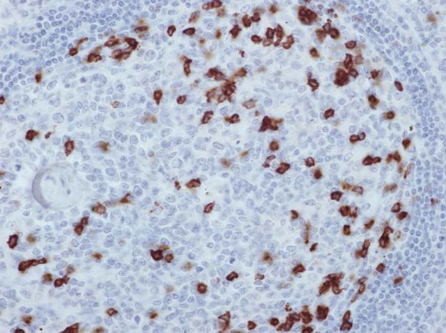 60-0091 61-0091 Ms x CD57 Stained Spleen 