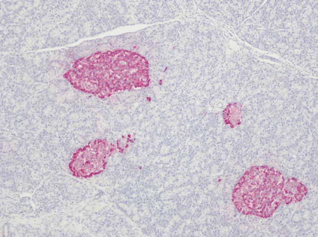 60-0015 61-0015 Rb x Chromogr A Pancreas 10x Fast Red 