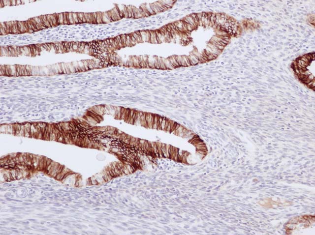 60-0019 61-0019 CK7 Uterus 