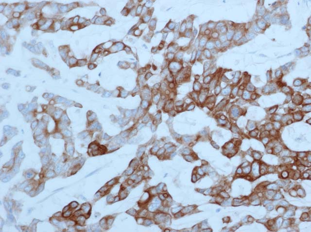 60-0018 61-0018 Ms x Cytokeratin 20 Colon Cancer 