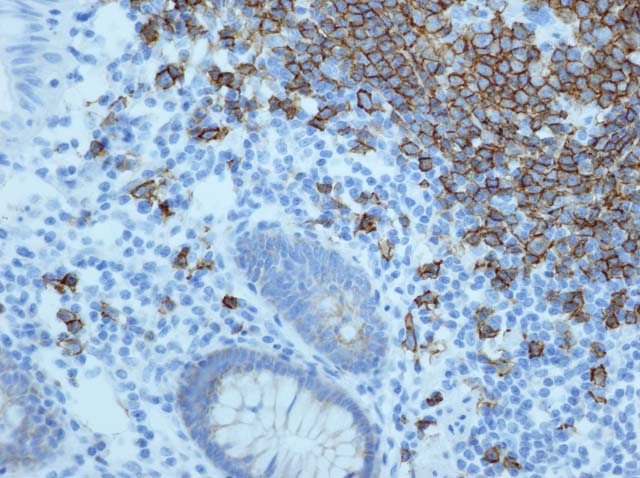 60-0010 61-0010 Ms x CD20 colon 