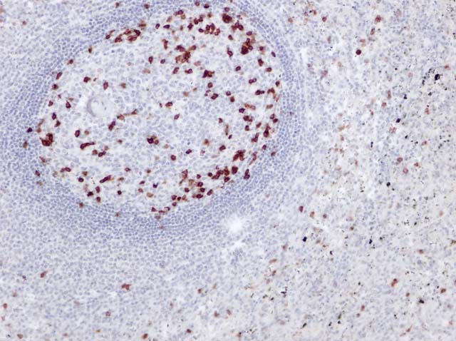 60-0091 61-0091 Ms x CD57 stained spleen 