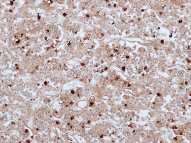 60-0125 61-0125 Rb x hCG stained pituitary 