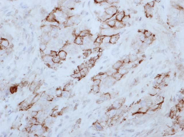 60-0127 61-0127 HBME-1 Mesothelioma 