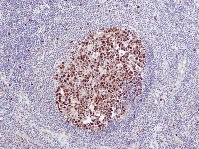 60-0054 61-0054 Ms x PCNA dil 250 NT Tonsil 